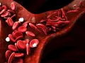 Naczynia krwionośne z prawidłowym i sierpowatym kształtem erytrocytów. Czy anemia może być ze stresu?