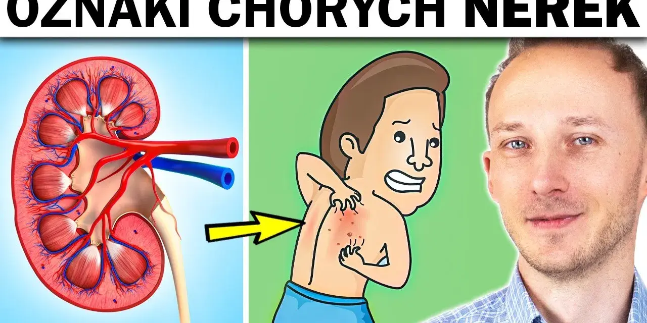 Niewydolność nerek objawy psychiczne: jak je rozpoznać i leczyć
