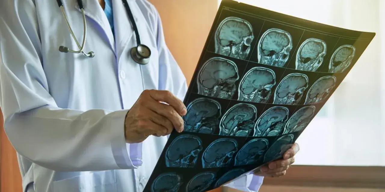 Jakie choroby psychiczne wykryje rezonans magnetyczny głowy i co to oznacza?