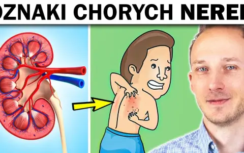 Niewydolność nerek objawy psychiczne: jak je rozpoznać i leczyć