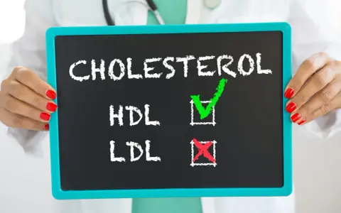 Tablica z napisem "CHOLESTEROL", HDL zaznaczone zielonym ptaszkiem, LDL czerwonym krzyżykiem. Czy wysoki cholesterol zawsze wymaga leków?