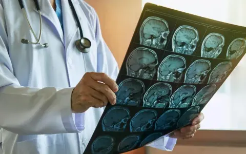 Jakie choroby psychiczne wykryje rezonans magnetyczny głowy i co to oznacza?