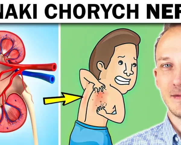 Niewydolność nerek objawy psychiczne: jak je rozpoznać i leczyć