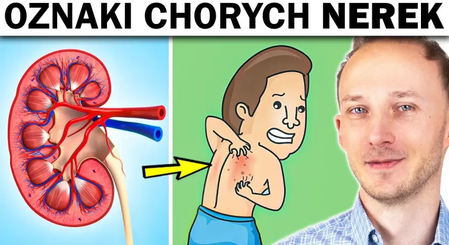 Niewydolność nerek objawy psychiczne: jak je rozpoznać i leczyć