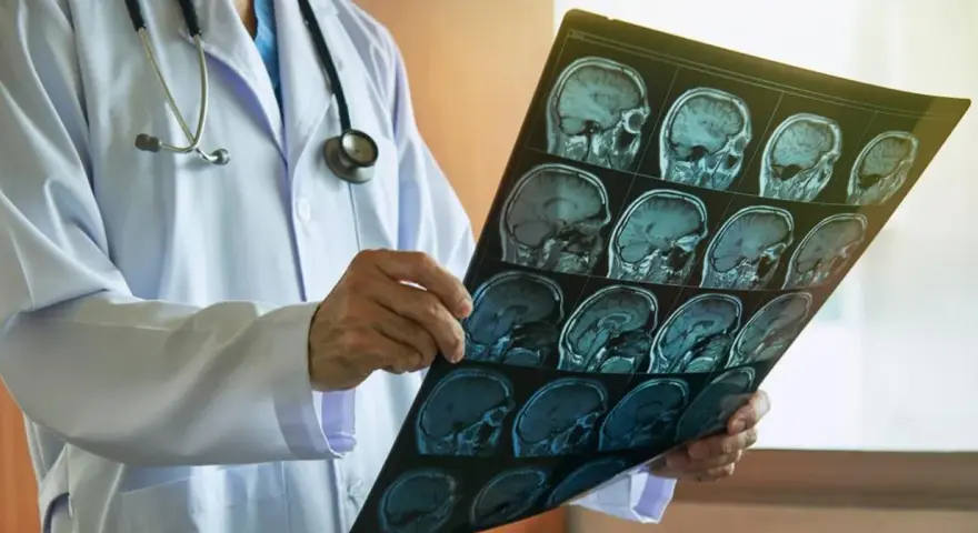 Jakie choroby psychiczne wykryje rezonans magnetyczny głowy i co to oznacza?