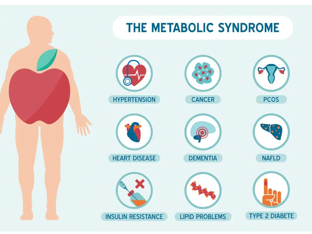 Ilustracja przedstawia zespół metaboliczny i jego powiązania z chorobami: nadciśnieniem, rakiem, PCOS, chorobami serca, demencją, NAFLD, insulinoopornością, problemami z lipidami i cukrzycą typu 2.
