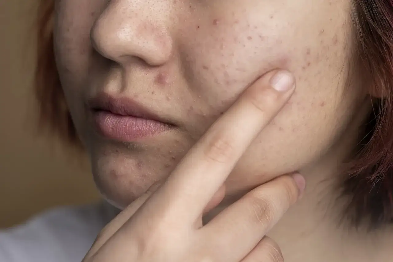 Zdjęcie Zaburzenia hormonalne: jakie badania pomogą zdiagnozować problemy?